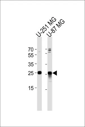 WB analysis of U-251 MG, U-87 MG cell using GTX81147 VTI1A antibody, C-term. Loading : 35ug per lane Dilution : 1:1000