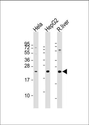 WB analysis of various samples using GTX81157 TSPAN31 antibody, Internal. Lane 1: HeLa whole cell lysate Lane 2: HepG2 whole cell lysate Lane 3: rat liver lysate Loading : 20 microg per lane Dilution : 1:2000