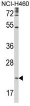 WB analysis of NCI-H460 cell lysate (35ug/lane) using GTX81157 TSPAN31 antibody, Internal.
