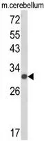 WB analysis of mouse cerebellum tissue lysate (35ug/lane) using GTX81158 USF2 antibody, Internal.