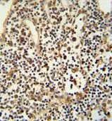 IHC-P analysis of human lymph tissue using GTX81161 ANO5 antibody, C-term.