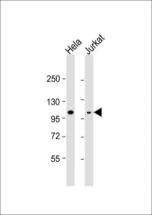 WB analysis of various samples using GTX81164 Rb antibody, C-term. Lane 1: HeLa whole cell lysate Lane 2: Jurkat whole cell lysate Loading : 20 microg per lane Dilution : 1:8000