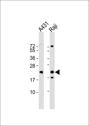 WB analysis of various samples using GTX81175 LMP2 antibody, C-term. Lane 1: A431 whole cell lysate Lane 2: Raji whole cell lysate Loading : 20 microg per lane Dilution : 1:1000