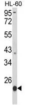 WB analysis of HL-60 cell lysate (35ug/lane) using GTX81175 LMP2 antibody, C-term.