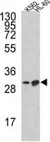 WB analysis of K562, HL-60 cell lysate (35ug/lane) using GTX81177 Bim antibody, Internal.