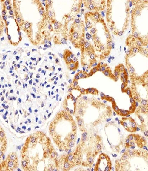 IHC-P analysis of human kidney tissue using GTX81177 Bim antibody, Internal. Dilution : 1:25