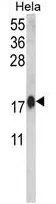 WB analysis of HeLa cell lysate (35ug/lane) using GTX81180 Calmodulin antibody, C-term.