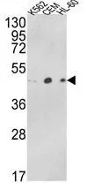 WB analysis of K562, CEM, HL-60 cell lysate (35ug/lane) using GTX81186 ACTR3B antibody, C-term.
