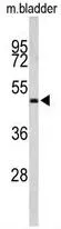 WB analysis of mouse bladder tissue lysate (35ug/lane) using GTX81186 ACTR3B antibody, C-term.