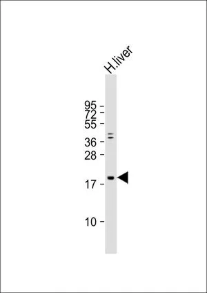 WB analysis of human liver lysate using GTX81187 IFN beta antibody, N-term. Loading : 20 microg per lane Dilution : 1:2000