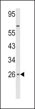 WB analysis of HepG2 cell lysate (35ug/lane) using GTX81187 IFN beta antibody, N-term.
