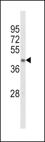 WB analysis of mouse kidney tissue lysate (35ug/lane) using GTX81189 ACADL antibody, Internal.