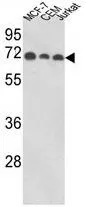 WB analysis of MCF-7, CEM, Jurkat cell lysate (35ug/lane) using GTX81190 SSH3BP1 antibody, N-term.
