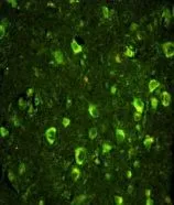 IHC-P analysis of human brain tissue using GTX81190 SSH3BP1 antibody, N-term. Green : SSH3BP1