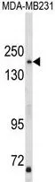 WB analysis of MDA-MB231 cell lysate (35ug/lane) using GTX81198 AS160 / TBC1D4 antibody, N-term. WB analysis of MDA-MB231 cell lysate (35ug/lane) using GTX81198 AS160 / TBC1D4 antibody, N-term.