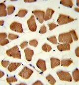 IHC-P analysis of human skeletal muscle using GTX81198 AS160 / TBC1D4 antibody, N-term.