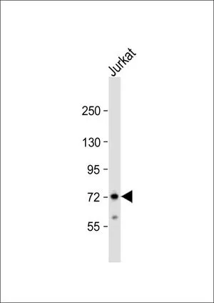 WB analysis of Jurkat whole cell lysate using GTX81199 ZFP36 antibody, Internal. Loading : 20 microg per lane Dilution : 1:1000 WB analysis of Jurkat whole cell lysate using GTX81199 ZFP36 antibody, Internal. Loading : 20 microg per lane Dilution : 1:1000