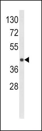 WB analysis of MDA-MB231 cell lysate (35ug/lane) using GTX81202 HLA-E antibody, Internal.