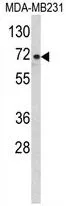 WB analysis of MDA-MB231 cell lysate (35ug/lane) using GTX81203 ARHGAP18 antibody, Internal. WB analysis of MDA-MB231 cell lysate (35ug/lane) using GTX81203 ARHGAP18 antibody, Internal.