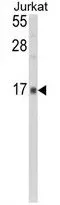 WB analysis of Jurkat cell lysate (35ug/lane) using GTX81256 GMFG antibody, N-term.