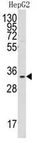 WB analysis of HepG2 cell lysate (35ug/lane) using GTX81280 C1qBP antibody, Internal. WB analysis of HepG2 cell lysate (35ug/lane) using GTX81280 C1qBP antibody, Internal.