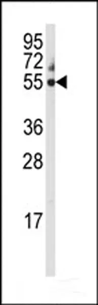 WB analysis of 293 cell lysate (35ug/lane) using GTX81287 Cytochrome P450 3A5 antibody, C-term.