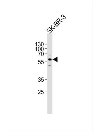 WB analysis of SK-BR-3 cell lysate using GTX81287 Cytochrome P450 3A5 antibody, C-term. Loading : 35ug Dilution : 1:1000