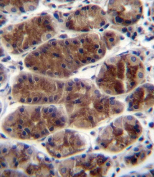 IHC-P analysis of human stomach tissue using GTX81297 CTGF antibody, Internal. IHC-P analysis of human stomach tissue using GTX81297 CTGF antibody, Internal.