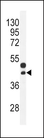 WB analysis of mouse bladder tissue lysate (35ug/lane) using GTX81297 CTGF antibody, Internal.