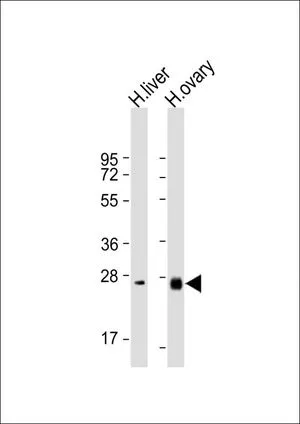 WB analysis of various samples using GTX81308 Neurotrophin 3 antibody, C-term. Lane 1: Human liver lysate Lane 2: Human ovary lysate Loading : 20 microg per lane Dilution : 1:2000 WB analysis of various samples using GTX81308 Neurotrophin 3 antibody, C-term. Lane 1: Human liver lysate Lane 2: Human ovary lysate Loading : 20 microg per lane Dilution : 1:2000