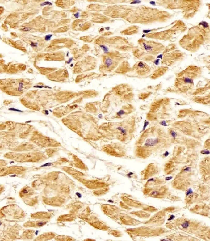IHC-P analysis of human heart tissue using GTX81334 ROR1 antibody. Antigen retrieval : heat-induced antigen retrieval with citrate buffer (pH6) Dilution : 1:25
