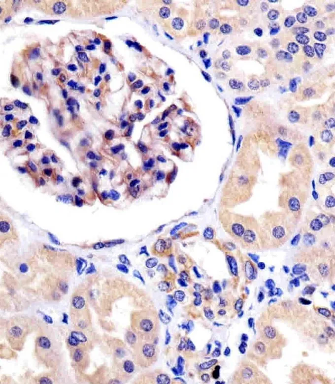 IHC-P analysis of human kidney tissue using GTX81334 ROR1 antibody. Antigen retrieval : heat-induced antigen retrieval with citrate buffer (pH6) Dilution : 1:25