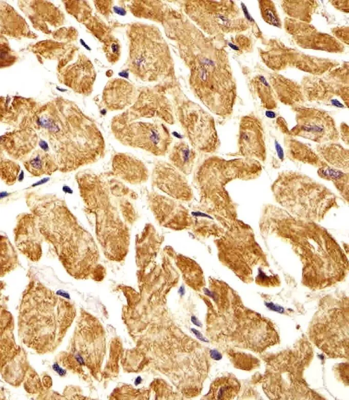 IHC-P analysis of human heart tissue using GTX81334 ROR1 antibody. Dilution : 1:25