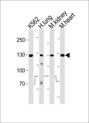 WB analysis of K562 cells, human lung, mouse kidney, mouse heart tissue using GTX81334 ROR1 antibody. Loading : 20ug per lane Dilution : 1:1000