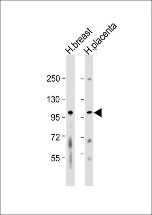 WB analysis of various samples using GTX81342 FGFR2 antibody, N-term. Lane 1: human breast lysate Lane 2: human placenta lysate Loading : 20 microg per lane Dilution : 1:1000