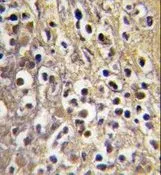 IHC-P analysis of human placenta tissue using GTX81387 Aromatase antibody, C-term. IHC-P analysis of human placenta tissue using GTX81387 Aromatase antibody, C-term.