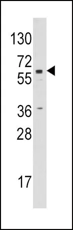 WB analysis of Jurkat cell lysate (35ug/lane) using GTX81387 Aromatase antibody, C-term.
