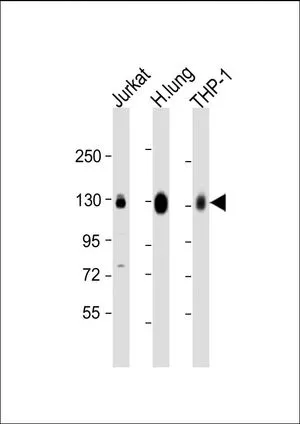 WB analysis of various samples using GTX81432 CD31 antibody, C-term. Lane 1: Jurkat whole cell lysate Lane 2: human lung lysate Lane 3: THP-1 whole cell lysate Loading : 20 microg per lane Dilution : 1:2000