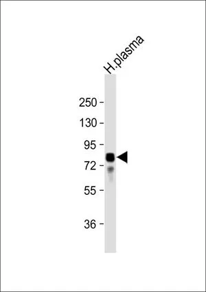 WB analysis of human plasma using GTX81434 Vitronectin antibody, N-term. Loading : 20 microg per lane Dilution : 1:32000