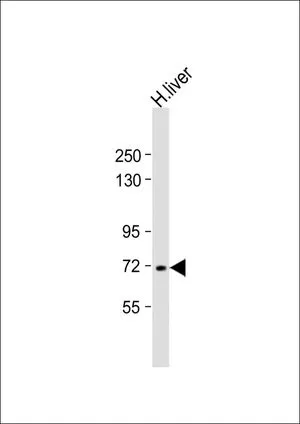 WB analysis of human liver lysate using GTX81434 Vitronectin antibody, N-term. Loading : 20 microg per lane Dilution : 1:8000