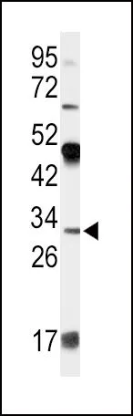 WB analysis of 293 cell lysate (35ug/lane) using GTX81463 Apolipoprotein D antibody, N-term. WB analysis of 293 cell lysate (35ug/lane) using GTX81463 Apolipoprotein D antibody, N-term.