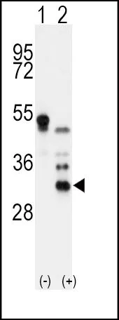WB analysis of 293 cell lysate (2 ug/lane) either nontransfected (Lane 1) or transiently transfected with the APOD (Lane 2) . using GTX81463 Apolipoprotein D antibody, N-term.