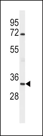 WB analysis of mouse brain tissue lysate (35ug/lane) using GTX81463 Apolipoprotein D antibody, N-term.