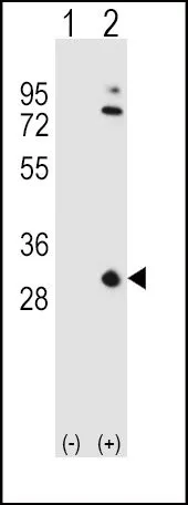 WB analysis of 293 cell lysate (2 ug/lane) either nontransfected (Lane 1) or transiently transfected with the Apolipoprotein A1(Lane 2) using GTX81467 Apolipoprotein A1 antibody, N-term.