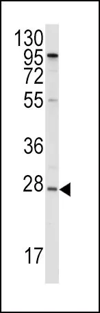 WB analysis of HepG2 cell lysate (35ug/lane) using GTX81467 Apolipoprotein A1 antibody, N-term.