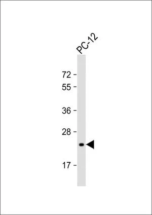 WB analysis of PC-12 whole cell lysate using GTX81492 DHFR antibody, C-term. Loading : 20 microg per lane Dilution : 1:2000