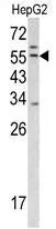 WB analysis of HepG2 cell lysate (35ug/lane) using GTX81494 TMPRSS2 antibody, Internal.