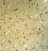 IHC-P analysis of mouse brain tissue using GTX81506 BCOR antibody, Internal. IHC-P analysis of mouse brain tissue using GTX81506 BCOR antibody, Internal.
