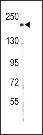 WB analysis of mouse lung tissue lysate (35ug/lane) using GTX81507 COL5A2 antibody, N-term. WB analysis of mouse lung tissue lysate (35ug/lane) using GTX81507 COL5A2 antibody, N-term.