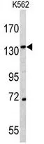 WB analysis of K562 cell lysate (35ug/lane) using GTX81526 CD163 antibody, N-term.